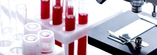 בדיקת CMV Antibodies IgM - תמונה